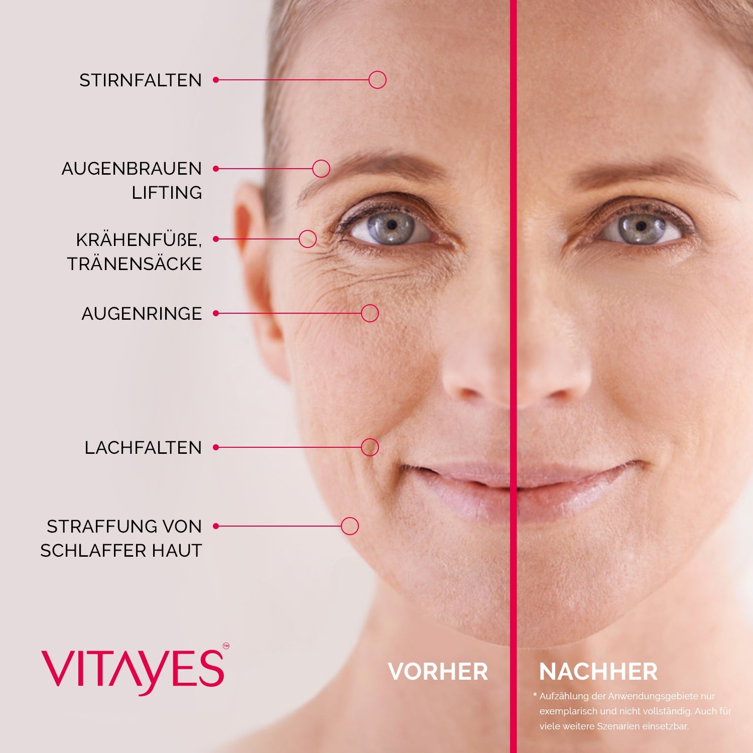 Instant Ageback Anti Aging Creme gegen Augenringe Tränensäcke Soforteffekt Faltencreme