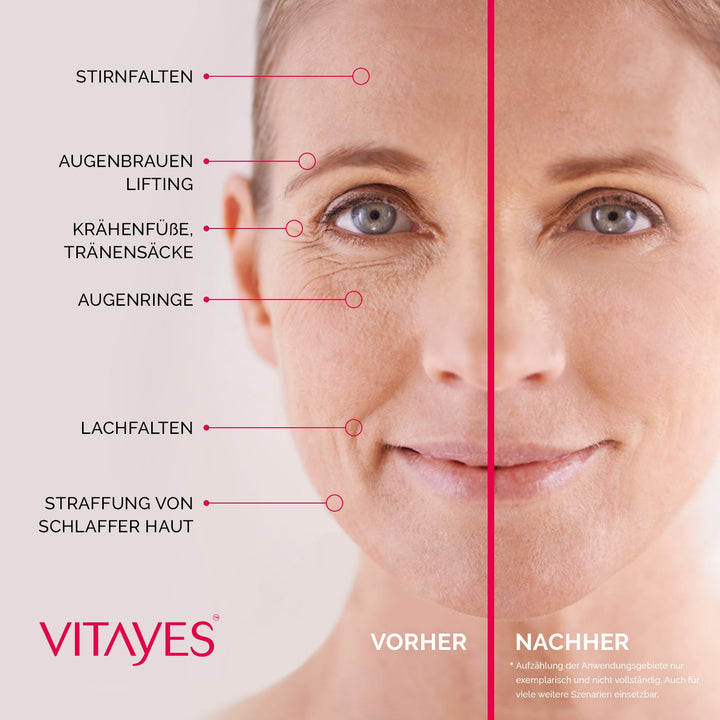 Instant Ageback Anti Aging Creme gegen Augenringe Tränensäcke Soforteffekt Faltencreme