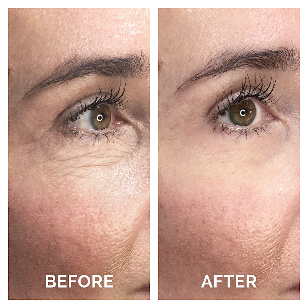 Instant Ageback Facelift - Instantly Reduce the Appearance of Eye Bags and Wrinkles 7 ml