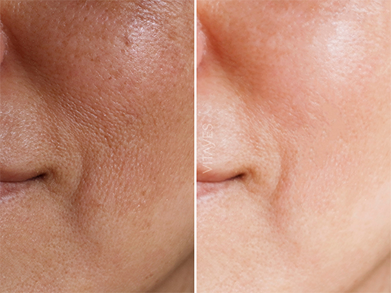 Vitayes Vitamin C Gesichtserum