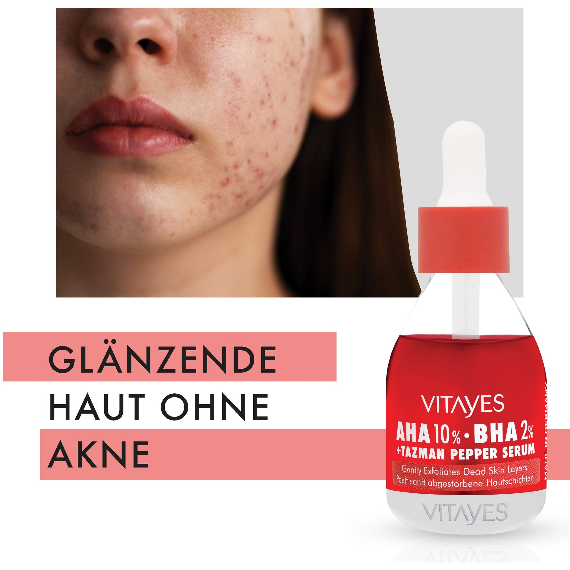 Vitayes AHA BHA anti-acne Serum
