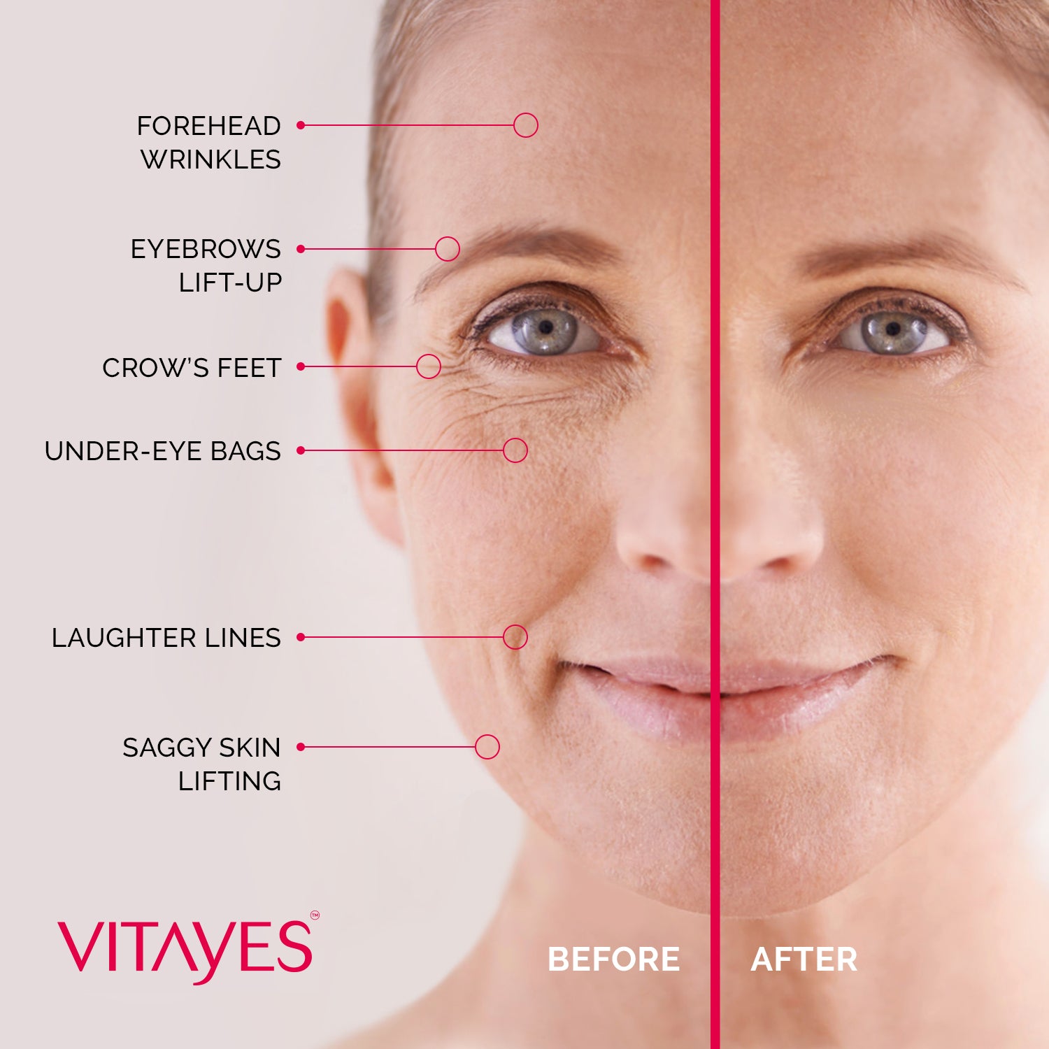 Smart second skin reduces eye bags and wrinkles – or so it seems