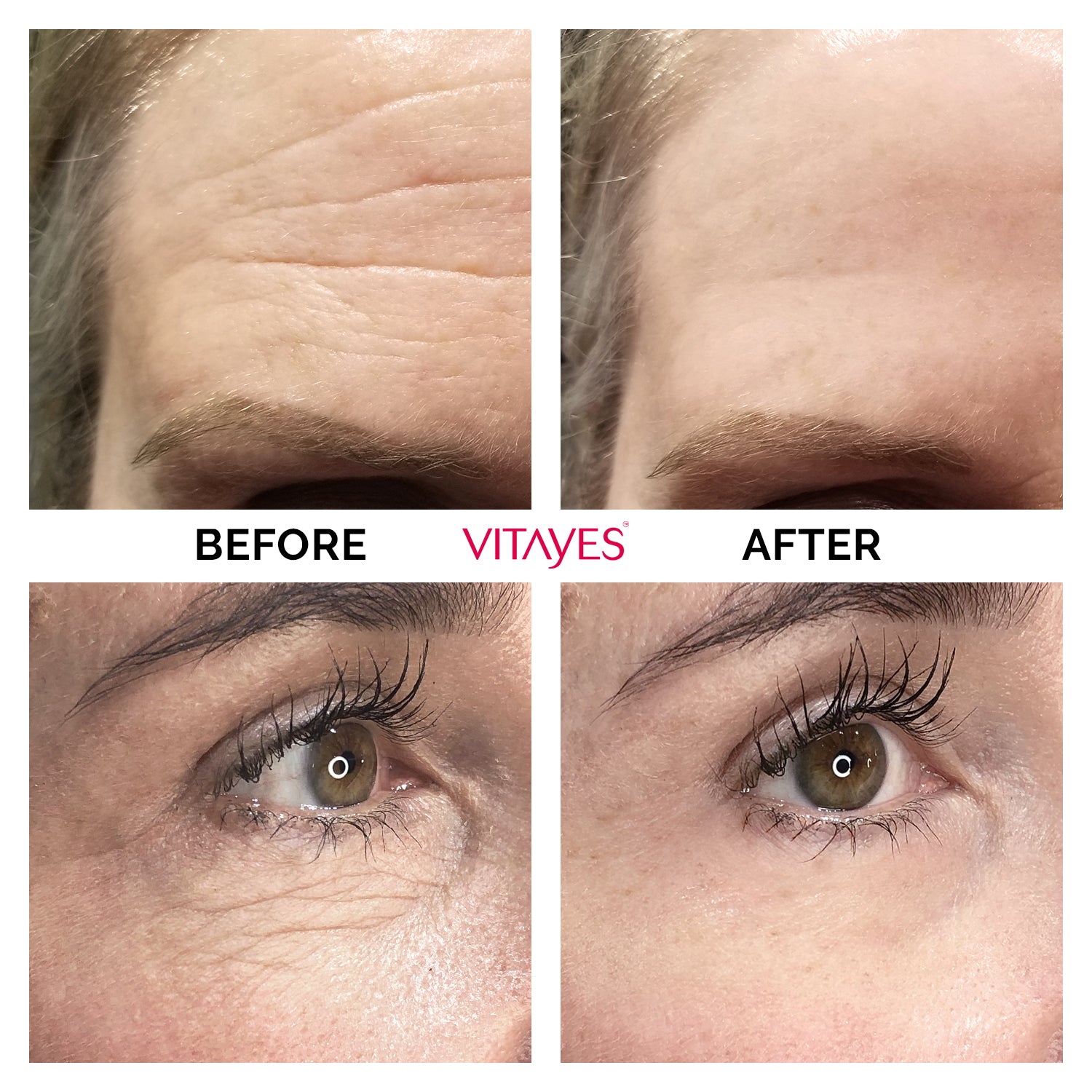 Instant Ageback Facelift - Instantly Reduce the Appearance of Eye Bags & Wrinkles 15 ml